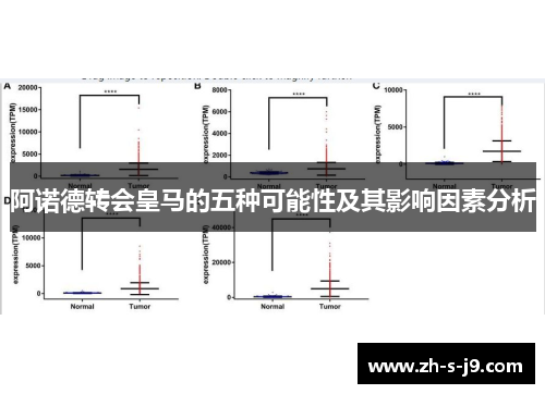 阿诺德转会皇马的五种可能性及其影响因素分析
